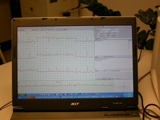  electrocardiogram  